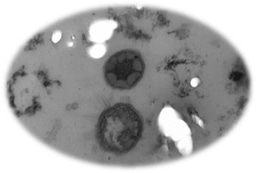 Dominant green sulfur bacteria inside coral skeleton