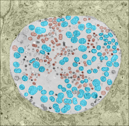 c-Myc, the gate watcher of glutamine umpire Chlamydial replication