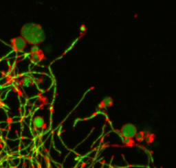 Bacterial growth under pressure: the surprising role of membrane microdomains