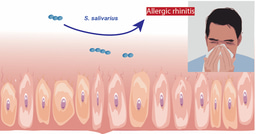 Respiratory tract commensal exacerbates allergic rhinitis