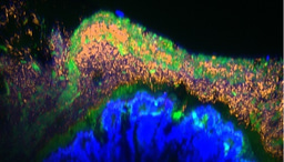 Planet of the microbes