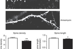 Editorial Summary: The differential role of cortical protein synthesis in taste memory formation and persistence