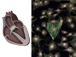 Transcatheter aortic valve replacements alter circulating serum factors to mediate myofibroblast deactivation 