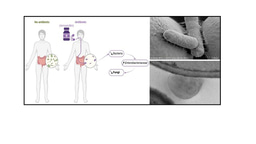 Antibiotic treatment also affects the intestinal fungal microbiota