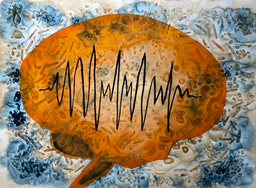 After the Paper: The ketogenic diet induces complex changes in the holobiont