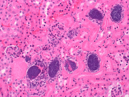 A new regulator of Staphylococcus aureus virulence