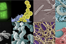 Time to reshape theory on bacterial form? 