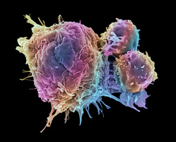Top 100 in Cancer | Scientific Reports
