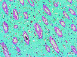 Experimental biology – Bioinspired engineering on a kidney chip to investigate renal calcification