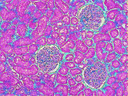 Precision Health on a kidney-on-a-chip: developing state-of-the-art microphysiology platforms