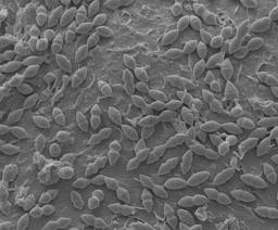 Pneumococcal Invaders of the Human Epithelium