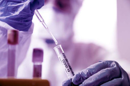 The COVID-19 XPRIZE and the need for scalable, fast, and widespread testing