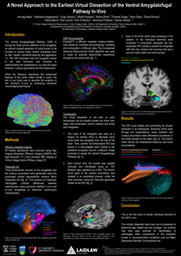 The Ventral Amygdalofugal Pathway: A Novel Approach to Virtual Dissection