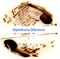 Diphtheria Dilemma