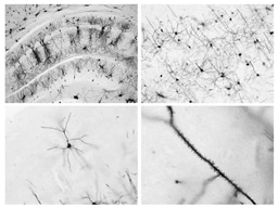  The Nightlight of Synapses: How the Brain Restores Electrical Balance In Sleep