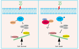 Leucine-rich repeat containing 4 act as an autophagy inhibitor that restores sensitivity of glioblastoma to Temozolomide