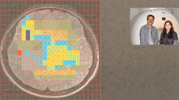 Hippocampal pH rise towards alkalinity: A perfect storm for Alzheimer’s disease