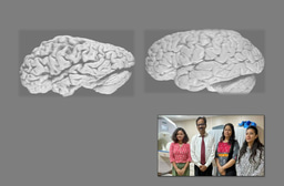 Glutathione and Iron Interplay in Alzheimer's: A Clue for Intervention?