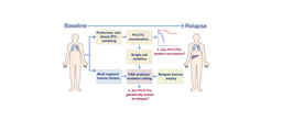Circulating tumour cells in the pulmonary vein of early stage non small cell lung cancer patients: what do they tell us about risk of relapse after surgery and seeding of metastasis?  