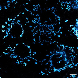 Multi-focal flat illumination for field-independent imaging