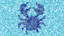 Nature Milestone: Cancer