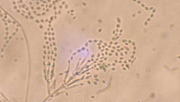 From the BugBitten Archives: Fungal compound inhibits transmission of malaria to mosquitoes