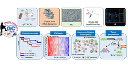 New insights into CTSL/ZBTB7B in gastric cancer prognosis and tumor microenvironment