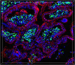 Hepatitis E virus: An underrated pathogen threatening human pregnancy 