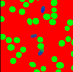Deep learning-based screening of sickle cell disease using a mobile microscope