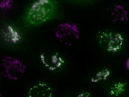 Women in Science profiles: Noemi Jiménez-Rojo