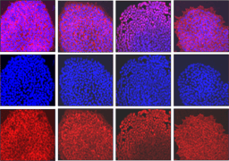 Targeting CREB-binding protein (CBP) abrogates colorectal cancer stemness through epigenetic regulation of C-MYC