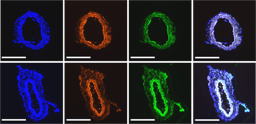 Targeting mechanosensitive cannabinoid receptor 1 with isoflavone prodrugs attenuates atherosclerotic endothelial dysfunction