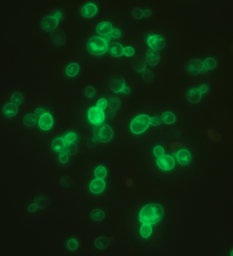 Finding a new family of azole drug importers in pathogenic fungi