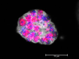 Environmental chlamydiae, the hot topic at an imaginary party