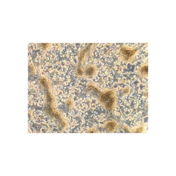 A handbook for making insulin-secreting β cells