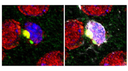 PQBP1, a new player for brain inflammation under neurodegeneration, suggests that disease proteins are recognized as exogenous pathogens by microglia