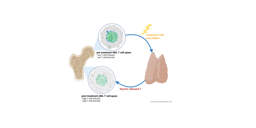 The underestimated role of bone marrow T cells as important predictor for treatment response and survival in acute myeloid leukemia