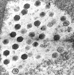 Viral channelrhodopsins
