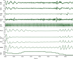 How can we diagnose sleep apnoea without bringing patients to the hospital?