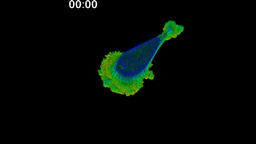  Gallery | A human breast cancer cell immediately shifts its shape at high viscosity