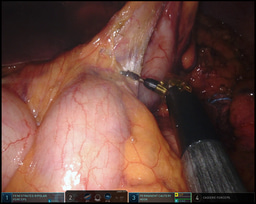 The Dresden Surgical Anatomy Dataset for abdominal organ segmentation in surgical data science