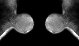 Discovery, hypothesis & Koch’s postulates – Nanohaloarchaeota are NOT free-living