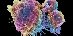 Top 100 in Cancer 2023 | Scientific Reports