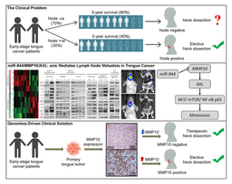miR-944/MMP10/ AXL- axis Predict Metastasis in Tongue Cancer