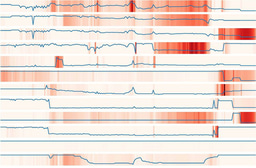 Dynamic Predictions of Postoperative Complications from Explainable, Uncertainty-Aware, and Multi-Task Deep Neural Networks