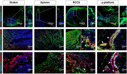 Spatio-temporal dynamics enhance cellular diversity, neuronal function and further maturation of human cerebral organoids 