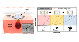 Spider-inspired tunable mechanosensor for biomedical applications