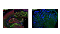 Maternal autoantibodies and autism spectrum disorder