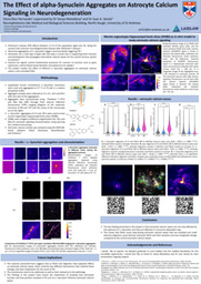 Research Poster: The Effect of alpha-Synuclein Aggregates on Astrocyte Calcium Signaling in Neurodegeneration