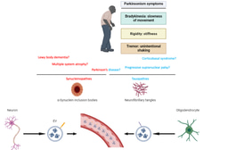 Failure of Biomarkers in Extracellular Vesicles for Parkinson's disease and Related Disorders Diagnosis